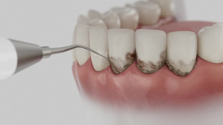 Reliable Dental Implants contractor in Germantown, WI by Smile Center Dentistry